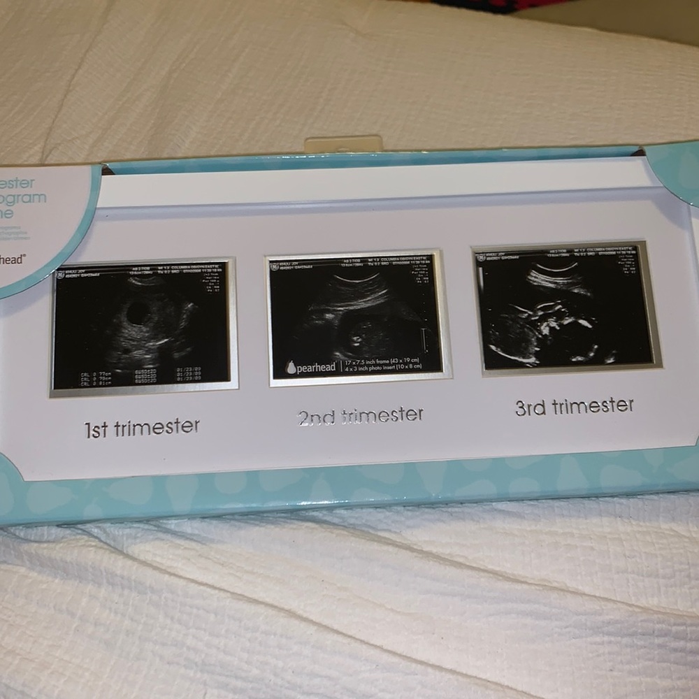 Trimester Sonogram Frame
